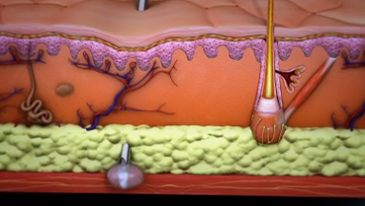 Botulinum toxin