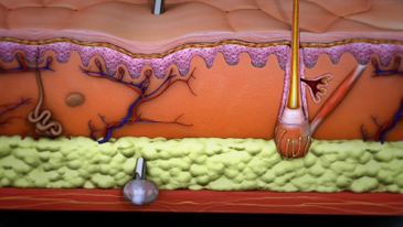 Botulinum toxin